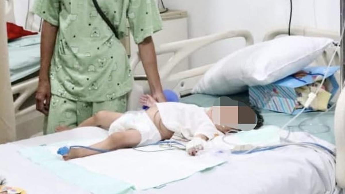Dirawat di PICU RSUD, Begini Kondisi Terkini Balita yang Keluarkan Cacing dari Mulut-Hidung di Bengkulu
