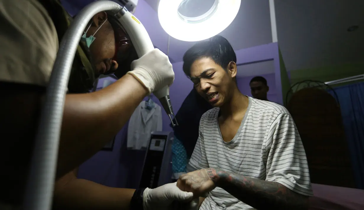 Ekspresi Fuad Ahmadi saat tato ditangannya ditembakan laser untuk dihapus di sebuah klinik di Tangerang (9/8). Program hapus tato ini sengaja dibuat untuk mereka yang ingin “berhijrah” dan ingin kembali lebih baik. (AP Photo/Achmad Ibrahim)