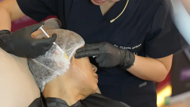  Menguak Inovasi Regenerative Contouring dalam Estetika Modern
