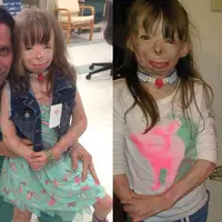 Kobaran api yang melahap apartemen keluarganya ternyata tak membuat semangatnya surut. Gadis kecil ini hanya ingin mengumpulkan kartu Natal.