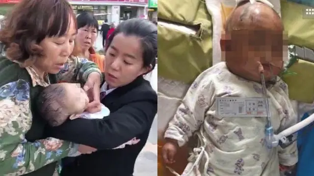 Bayi Mengalami Koma, Setelah Tertimpa Buah Apel yang Terjatuh dari Lantai 24