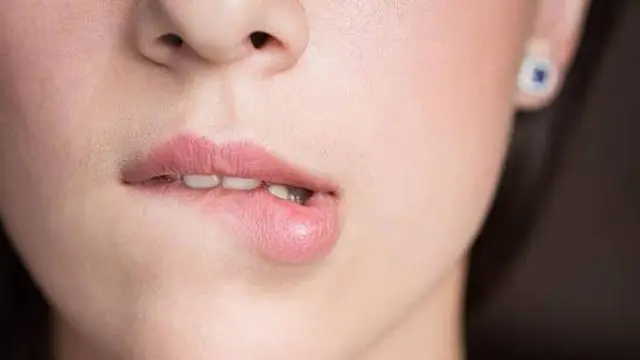 Cara mudah menjaga bibir merah alami, sumber: Fimela.com