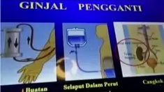 Praktik perdagangan ginjal ilegal terbongkar setelah seorang tahanan Garut mengaku salah satu ginjalnya telah dijual.
