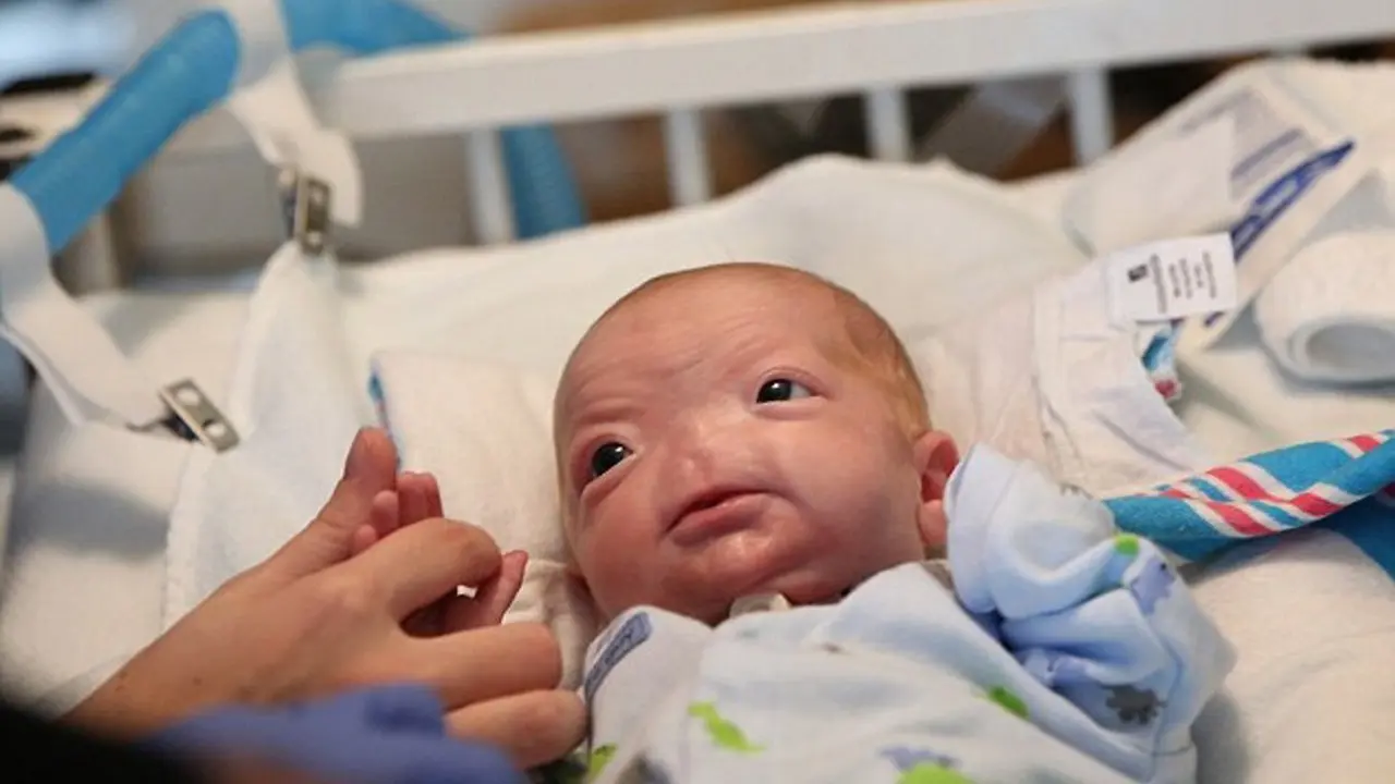 Terlahir Tanpa Hidung, Bayi Ini Masih Punya Wajah Menggemaskan