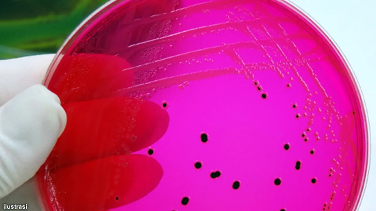salmonella-130820b.jpg