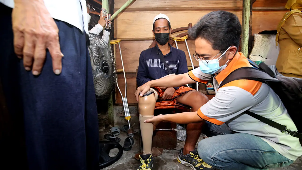 Abdul Manan, Difabel Surabaya mendapatkan kaki palsu. (Dian Kurniawan/Liputan6.com)