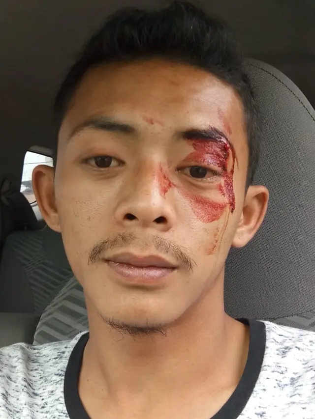 Salah satu driver angkutan online, korban penganiayaan ojek pangkalan di Garut, Jawa Barat