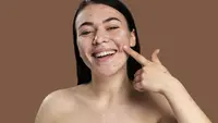 Potret perempuan tersenyum bangga menunjukan jerawatnya/copyright freepik.com/freepik