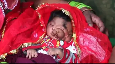 Seorang bayi asal India terlahir dengan hidung yang tampak seperti belalai gajah.Bayi ini dipercayai oleh masyarakat India sebagai reinkarnasi dari dewa Ganesha