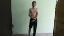 Taufiq Hidayat menunggu untuk menghapus tatonya di sebuah klinik di Tangerang (9/8). Program hapus tato ini sengaja dibuat untuk mereka yang ingin “berhijrah” dan ingin kembali lebih baik. (AP Photo/Achmad Ibrahim)