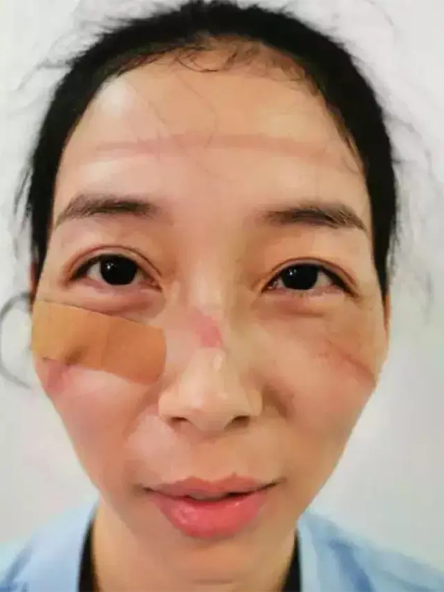 6 Potret Wajah Suster Rawat Pasien Virus Corona Ini Bikin Haru