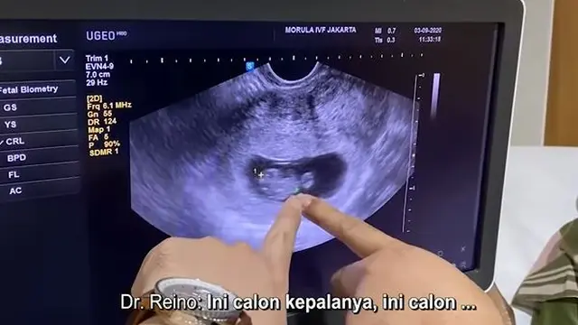 Mulai Rasakan Mual, Ini 6 Momen Zaskia Sungkar Cek USG Pertama Kali