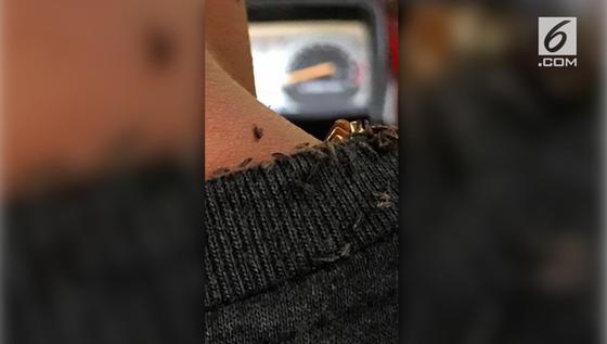 VIDEO: Naik Becak Motor, Pria Ini Dipenuhi Kutu