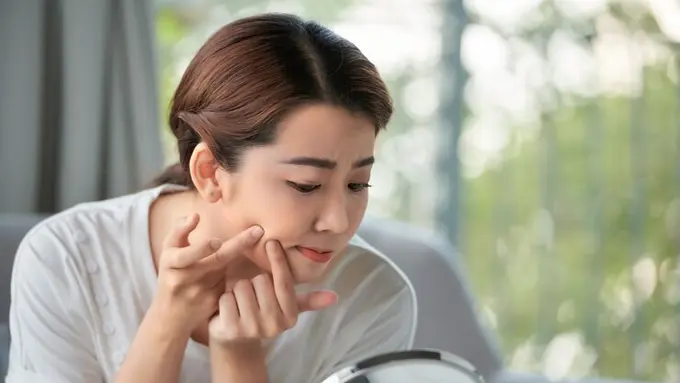 Sirsak mampu mengobati jerawat dan rambut rontok