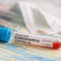 ilustrasi virus corona/copyright by diy13 (Shutterstock)