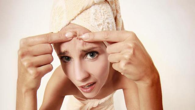 Tips hilangkan jerawat