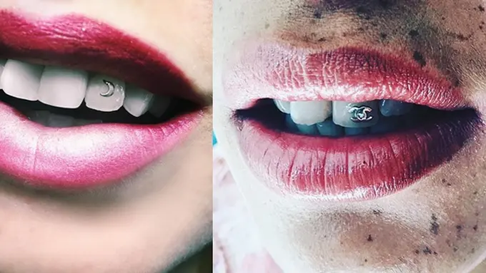 Foto: copyright instagram/#toothgems