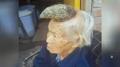 Xiuzhen bahkan pernah mematahkan tanduk tersebut ketika ukurannya masih sebesar jari kelingking, tapi anehnya tanduk itu justruk berkembang dan membesar setiap bulannya.