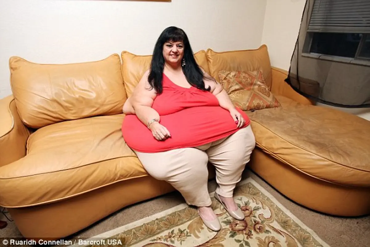 Putus, Perempuan Obesitas Ini Ingin Turunkan Berat Badan