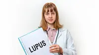 Lupus, Penyakit yang Selalu Mengintai Wanita