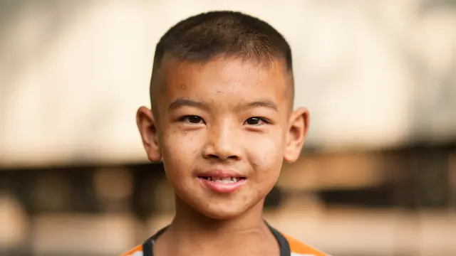 Kiat agar Tidak Muncul Bekas Cacar Air di Kulit (Bonga1965/Shutterstock)