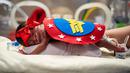 Infant Calixta Renteria mengenakan kostum Wonder Woman saat menjalani perawatan di bagian NICU sebuah rumah sakit di Texas, Rabu (30/10/2019). Pihak RS memakaikan kostum pada bayi-bayi prematur untuk merayakan Halloween pertama mereka. (Sarah A. Miller/Tyler Morning Telegraph via AP)