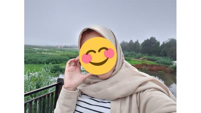 Wanita Ini Minta Jerawat Dihilangkan, 6 Hasil Editan Foto Bikin Senyum