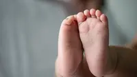 Congenital Talipes Equinovarus, Kelainan Bawaan yang Bisa Bikin Anak Sulit Berjalan  