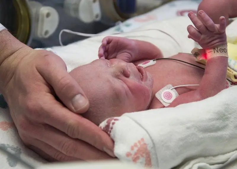 Bayi mungil pun lahir dari wanita yang tak punya rahim. (Baylor University Medical Center, Dallas)