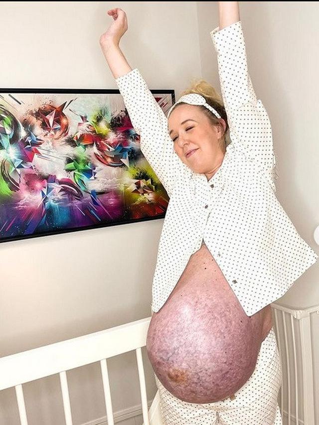 Wanita ini Bagikan Momen Kehamilannya dengan Bayi Kembar 3