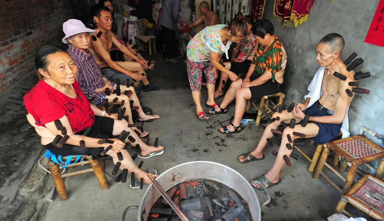 Suasana klinik yang menggunakan terapi bekam di Pujiang County, Chengdu, Tiongkok (10/8). Terapi bekam ini dipercaya bisa menyembuhkan berbagai macam penyakit. (REUTERS)