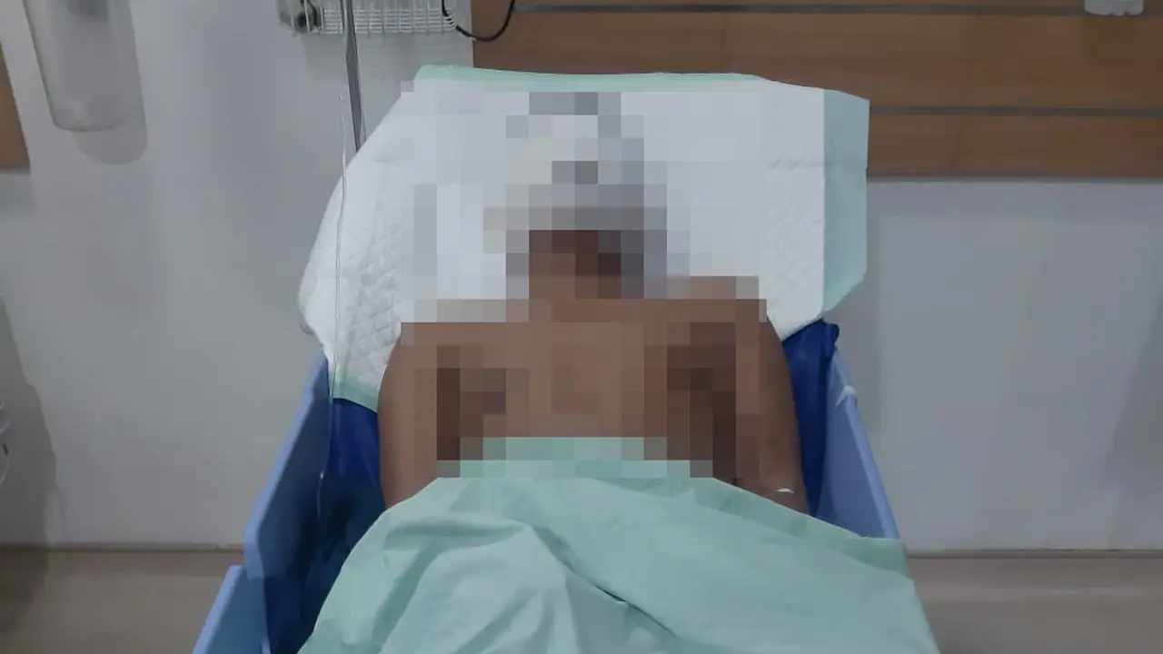 Wartawan Medan Disiram Air Keras