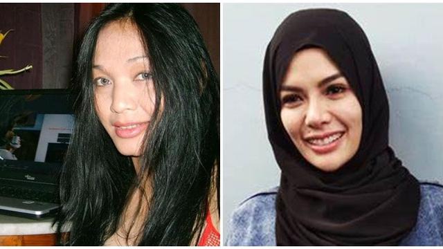 Sama-Sama Pernah Oplas, Ini 6 Potret Transformasi Wajah Bunda Corla dan Nikita Mirzani