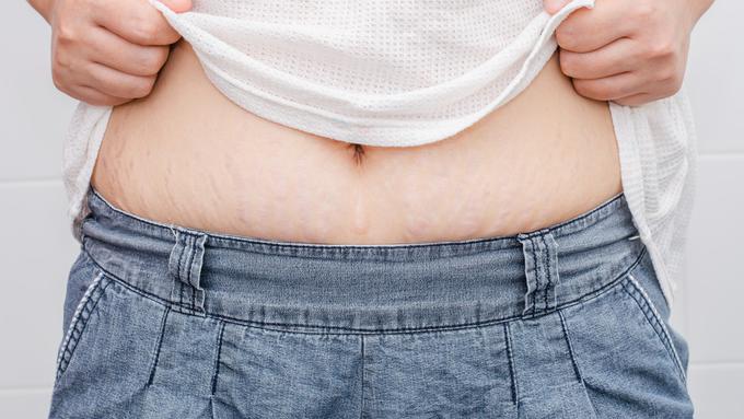 Jangan Panik Ini 4 Cara Untuk Atasi Flek Hitam Yang Halodoc