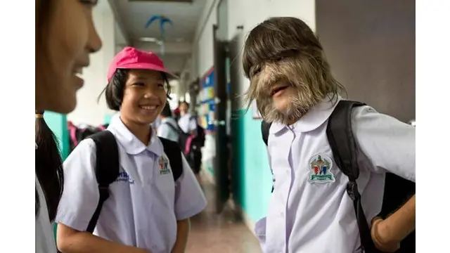 Para orangtua anak-anak ini pastinya berharap anaknya dapat sembuh dan hidup normal kembali.