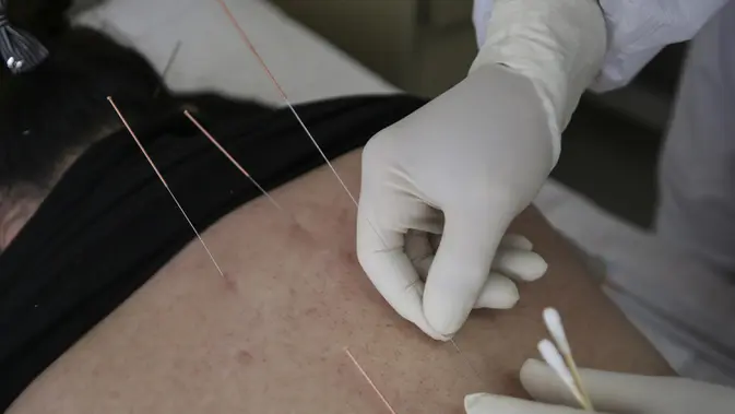 Akupunktur Berujung Petaka, 10 Jarum Tertinggal di Kaki Wanita