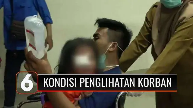 Begini penjelasan tim dokter usai operasi, terkait kondisi penglihatan bocah perempuan yang alami tindak kekerasan. Sementara itu, polisi telah menetapkan kedua orang tua korban menjadi tersangka.