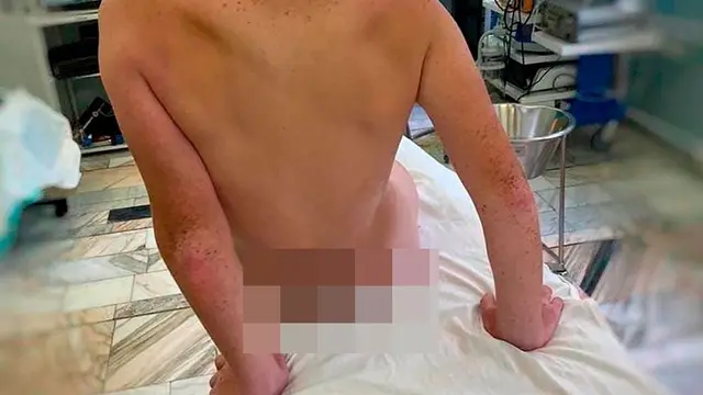 Hampir Terkena Alat Vitalnya, Kisah Bocah yang Tertusuk Alat Pancingan Ini Bikin Pilu