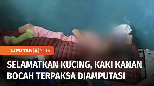 VIDEO: Pilu! Selamatkan Kucing Peliharaan, Kaki Bocah 6 SD di Labuhanbatu Terpaksa Diamputasi