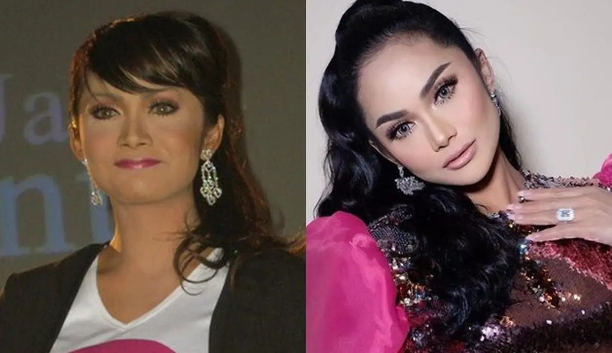 Krisdayanti sering sekali mendapati rumor bahwa wajahnya operasi plastik. Krisdayanti memang sempat mengutarakan pernah melakukan operasi plastik seperti di bagian payudara dan perut. Meski begitu ia membantah operasi plastik di wajah. (Liputan6.com/IG/krisdayantilemos)