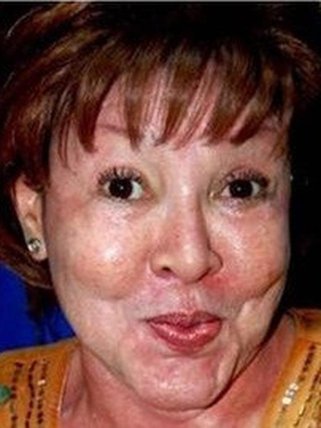 5 Foto Jadul Mpok Atiek dari Muda Hingga Awal-Awal Operasi Plastik