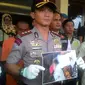 Kapolres Garut AKBP Budi Satria Wiguna menunjukan sejumlah hasil rontgen patahan tulang tangan bayi korban kekerasan di Garut (Liputan6.com/Jayadi Supriadin)