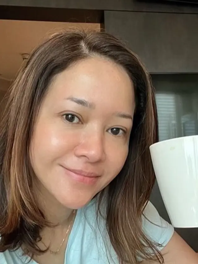 Maia Estianty derita rosacea, setelah perawatan (Instagram/maiaestiantyreal)