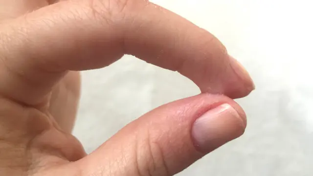 Cara Menghilangkan Bekas Lem Korea di Tangan