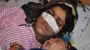 Reza Gul (20) ditemani bayinya menjalani perawatan di rumah sakit di Provinsi Faryab, Afghanistan, 19 Januari 2016. Wanita yang telah enam tahun menikah itu mengalami cacat fisik setelah sang suami memotong hidungnya dengan pisau (AFP PHOTO/Hasan Sirdash)