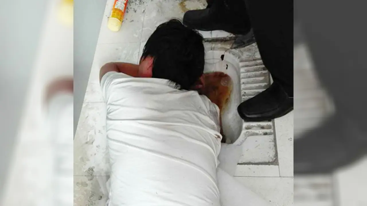 Demi Selamatkan Smartphone, Tangan Pria Ini Terjebak di Toilet