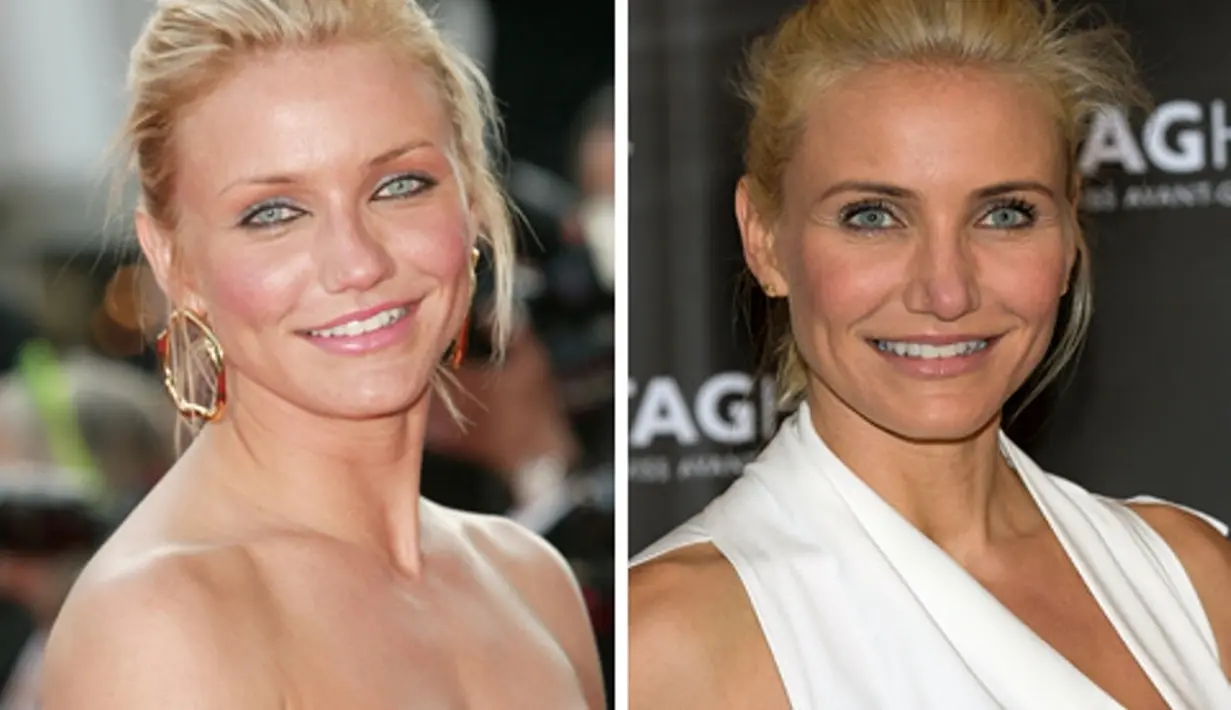 Cameron Diaz pun tampil berbeda usai melakukan operasi hidung. (Latina)