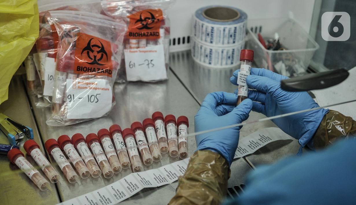 Tim medis memberikan label pada tabung sampel sebelum diuji di laboratorium pemeriksaan Covid-19 di Labkesda DKI Jakarta, Selasa (4/8/2020). Labkesda DKI yang berjejaring dengan 47 lab se-Jakarta dalam sehari mampu menguji hampir 10.000 spesimen Covid-19 dengan metode PCR (merdeka.com/Iqbal Nugroho)