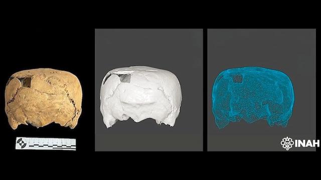 Tengkorak manusia menyerupai bentuk kubus berusia 1400 tahun