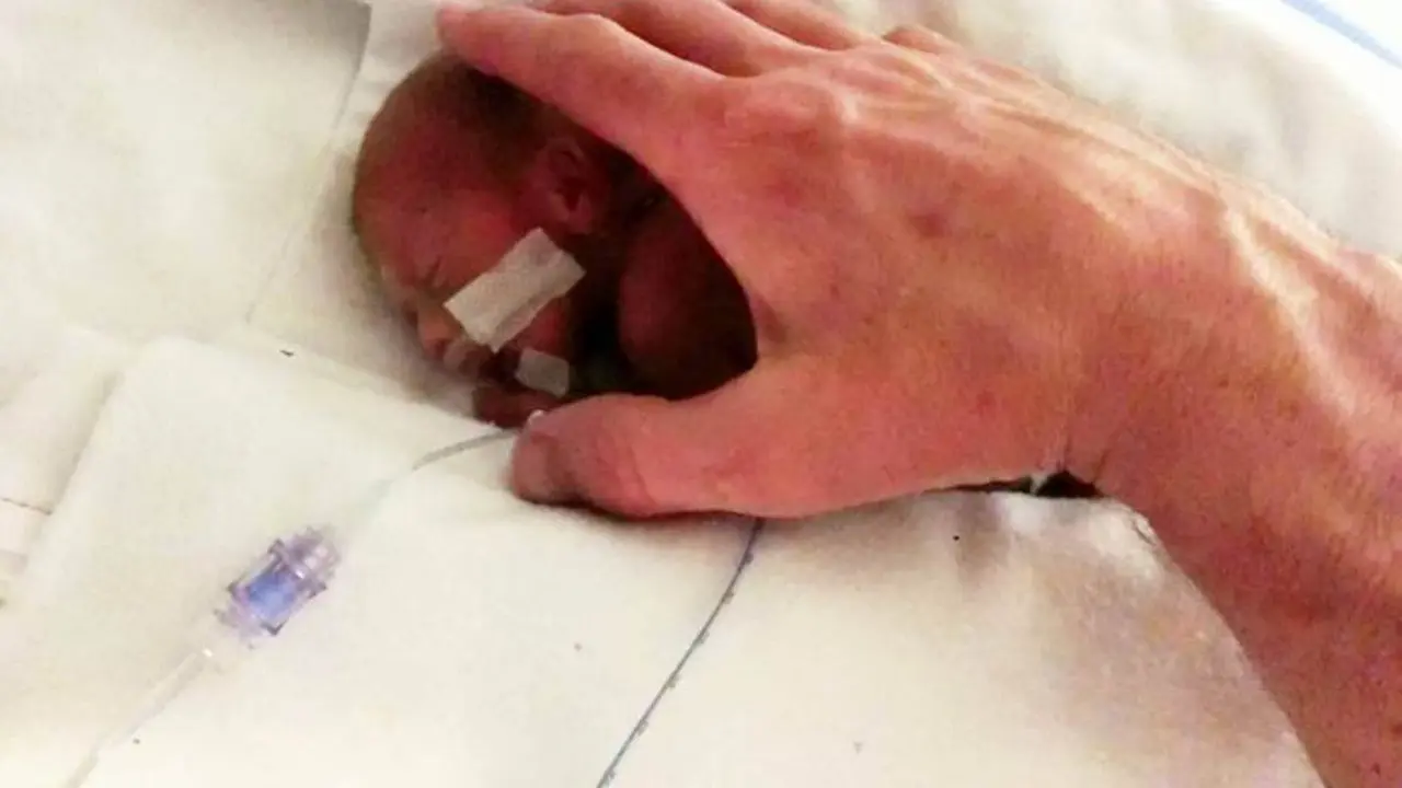 Jett Morris bayi prematur 25 Minggu. (Metro.co.UK)